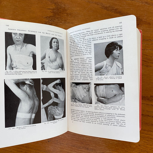 Pye's Surgical Handicraft Vol 1 - Hamilton Bailey